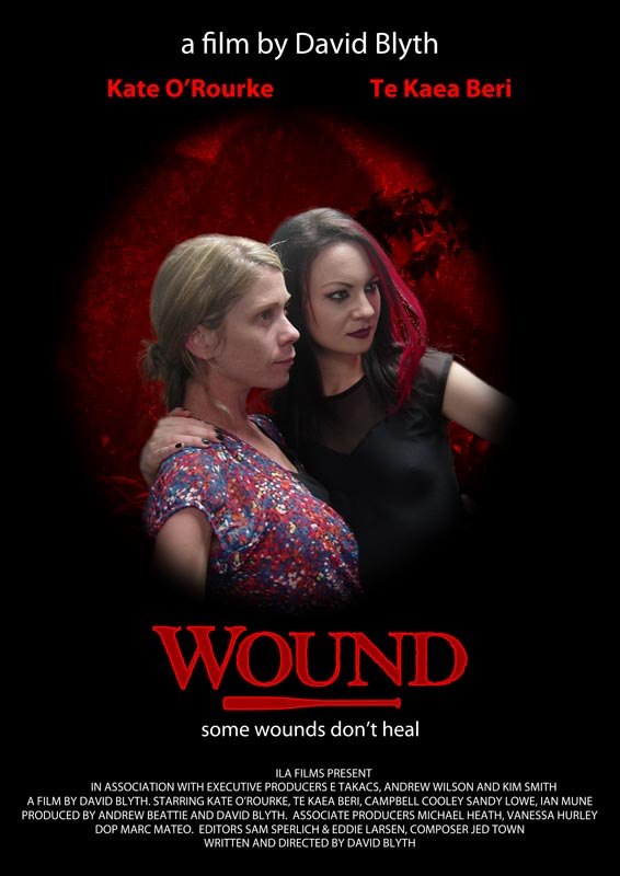 Wound